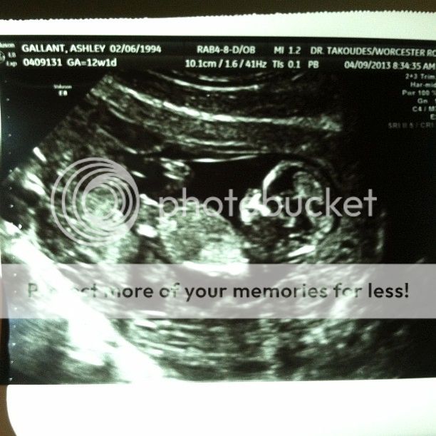 ultrasound12weeks1day2_zpse03284b1.jpg