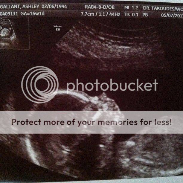 ultrasound257_zps9ced2598.jpg